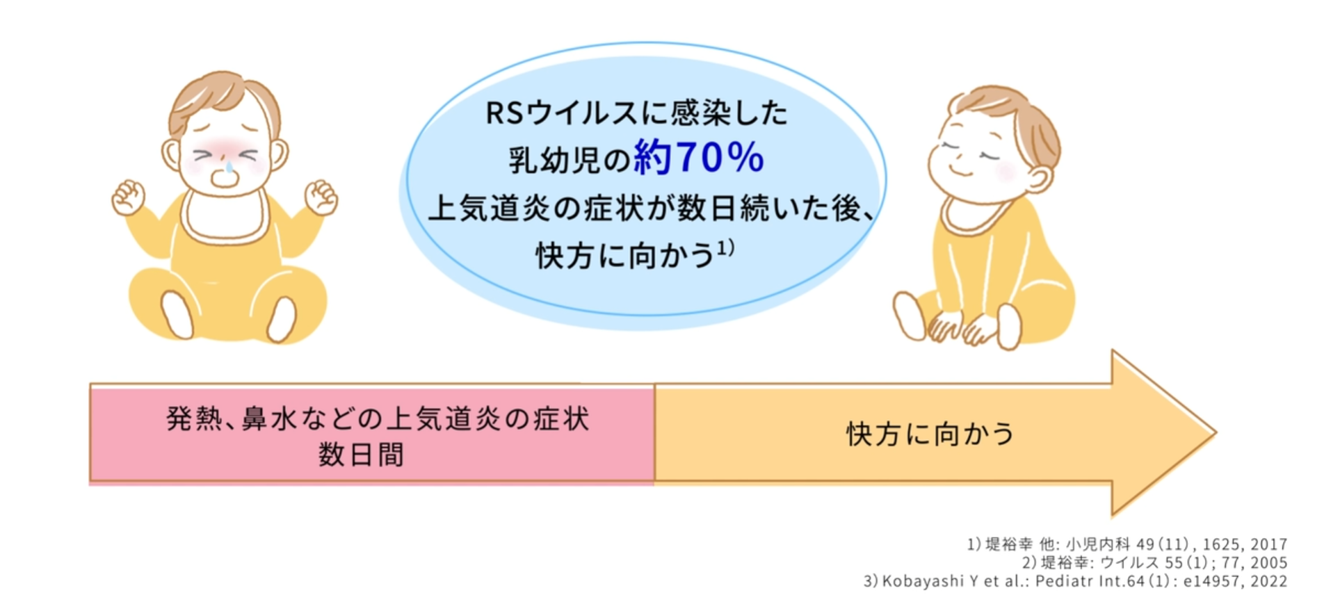 RSウイルスが下気道に感染後、軽症化するイメージ。