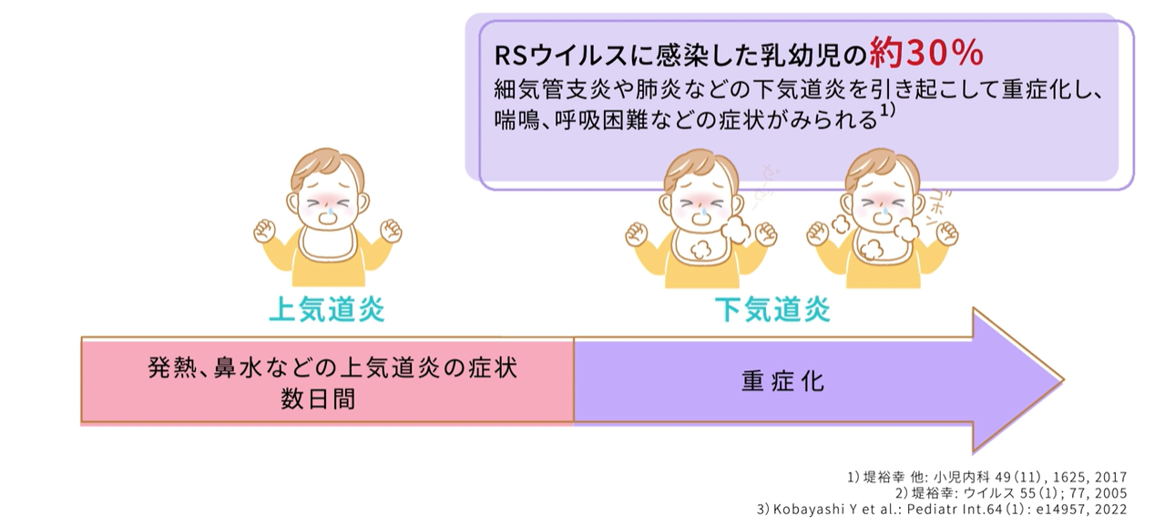 RSウイルスが下気道に感染後、重症化するイメージ。