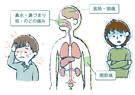 インフルエンザの症状