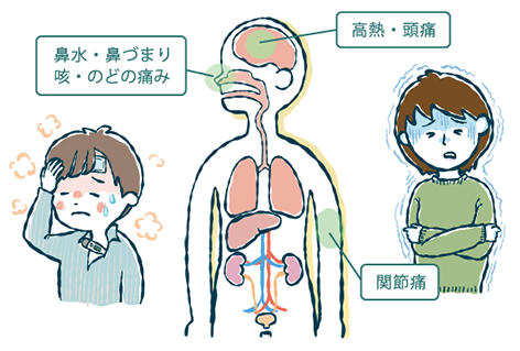 インフルエンザの症状イラスト（発熱・咳・のどの痛み・消化器症状）